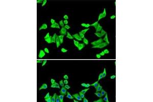 Immunofluorescence analysis of U2OS cells using PTH Polyclonal Antibody (PTH 抗体)