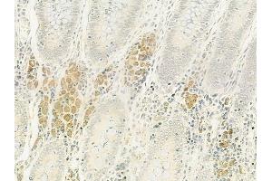 ABIN6264305 and ABIN6272862 at 1/100 staining human normal colon tissue by IHC-P.
