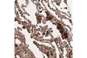 Immunohistochemical staining of human lung with ARL13A polyclonal antibody  shows strong cytoplasmic positivity in macrophages at 1:20-1:50 dilution. (ARL13A 抗体)