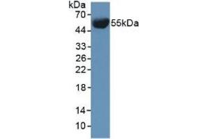 Detection of INV in Mouse Serum using Polyclonal Antibody to Involucrin (INV) (Involucrin 抗体  (AA 301-460))
