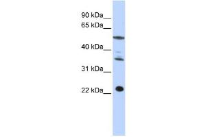 Western Blotting (WB) image for anti-Centromere Protein M (CENPM) antibody (ABIN2459009) (CENPM 抗体)