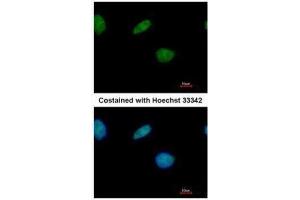 ICC/IF Image Immunofluorescence analysis of paraformaldehyde-fixed A549, using LXR beta, antibody at 1:500 dilution. (NR1H2 抗体  (N-Term))