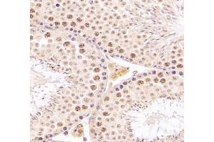 Immunohistochemistry of paraffin embedded mouse testis using DMRTA2 (ABIN7073753) at dilution of 1: 700 (400x lens) (DMRTA2 抗体)