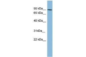 WB Suggested Anti-PRKCB1 Antibody Titration: 0. (Pkc beta 1 抗体  (N-Term))