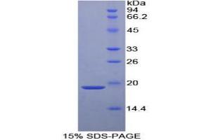 SDS-PAGE analysis of Human a2PI Protein. (alpha 2 Antiplasmin 蛋白)