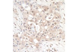 anti-RAB Guanine Nucleotide Exchange Factor (GEF) 1 (RABGEF1) (AA 475-525) antibody