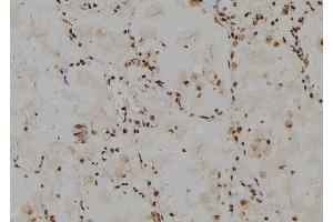 ABIN6274778 at 1/100 staining Human lung tissue by IHC-P.
