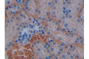 Immunohistochemistry (IHC) image for anti-Basigin (Ok Blood Group) (BSG) (AA 87-323) antibody (ABIN7441883)