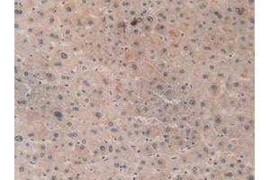 IHC-P analysis of Human Liver Tissue, with DAB staining. (ACAT2 抗体  (AA 1-397))