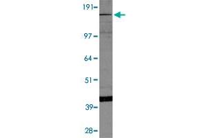 Western blot of HepG2 cell lysate with Kdm6b polyclonal antibody . (Kdm6b 抗体  (AA 600-650))