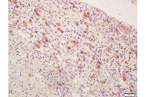 Formalin-fixed and paraffin embedded human placenta tissue labeled with Rabbit Anti-Inhibin Alpha Polyclonal Antibody, Unconjugated (ABIN1715125) at 1:200 followed by conjugation to the secondary antibody and DAB staining (Inhibin alpha 抗体  (AA 281-366))