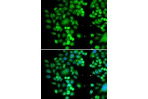 Immunofluorescence analysis of MCF7 cell using PHYHD1 antibody. (PHYHD1 抗体)