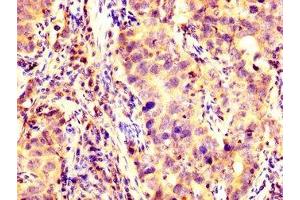 Immunohistochemistry (IHC) image for anti-Potassium Voltage-Gated Channel, Shaker-Related Subfamily, beta Member 1 (KCNAB1) (AA 287-401) antibody (ABIN7175618)