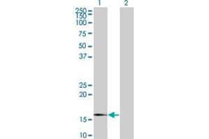 Western Blot analysis of SNCG expression in transfected 293T cell line by SNCG monoclonal antibody (M01A), clone 2C3. (SNCG 抗体  (AA 21-127))