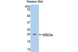 Detection of Recombinant IL18, Human using Polyclonal Antibody to Interleukin 18 (IL18) (IL-18 抗体  (AA 37-193))