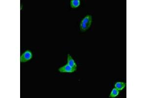 Immunofluorescent analysis of HepG2 cells using ABIN7172313 at dilution of 1:100 and Alexa Fluor 488-congugated AffiniPure Goat Anti-Rabbit IgG(H+L) (TOX3 抗体  (AA 8-305))