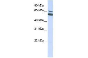 ALOX15B antibody used at 1 ug/ml to detect target protein. (ALOX15B 抗体  (N-Term))