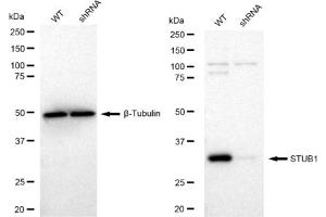 Western blotting analysis using STUB1 antibody (ABIN7800441).