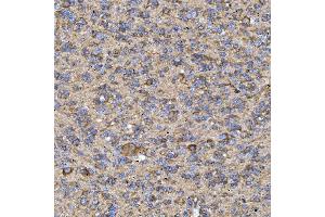 IHC analysis of RAB3GAP1 using anti-RAB3GAP1 antibody (ABIN7599702).