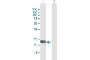 Western Blot analysis of LOH12CR1 expression in transfected 293T cell line by LOH12CR1 MaxPab polyclonal antibody. (LOH12CR1 抗体  (AA 1-196))