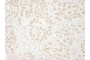 anti-Ubiquitin Specific Peptidase 37 (USP37) (C-Term) antibody