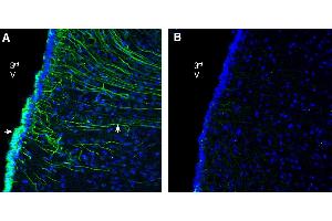 Expression of GPR142 in rat ventromedial hypothalamus.