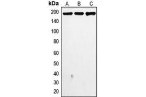 Western blot analysis of Topoisomerase 2 alpha expression in MDAMB468 (A), MDAMB231 (B), HeLa (C) whole cell lysates.