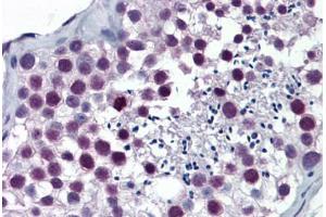 Human Testis: Formalin-Fixed, Paraffin-Embedded (FFPE) (ARNT 抗体  (AA 1-110))