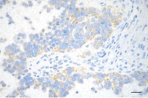 anti-Sorting and Assembly Machinery Component 50 Homolog (SAMM50) antibody