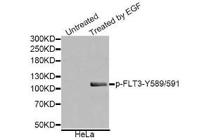 Western blot analysis of extracts of various cell lines, using Phospho-FLT3-Y589/591 antibody. (FLT3 抗体  (pTyr589, pTyr591))