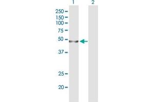 Western Blot analysis of WDR41 expression in transfected 293T cell line by WDR41 polyclonal antibody (A01). (WDR41 抗体  (AA 1-459))
