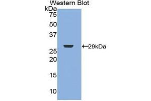 Western Blotting (WB) image for anti-Neurofibromin 2 (NF2) (AA 30-239) antibody (ABIN1859996) (Merlin 抗体  (AA 30-239))