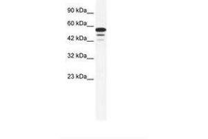 Image no. 1 for anti-Zinc Finger Protein 230 (ZNF230) (AA 133-182) antibody (ABIN6735984) (ZNF230 抗体  (AA 133-182))