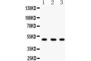 Western Blotting (WB) image for anti-C-terminal Binding Protein 2 (CTBP2) (AA 321-445) antibody (ABIN3042768) (CTBP2 抗体  (AA 321-445))