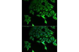 Immunofluorescence analysis of U2OS cell using TSC22D3 antibody. (TSC22D3 抗体)