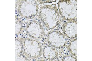 Immunohistochemistry of paraffin-embedded human stomach using BCL2L2 antibody (ABIN5970504) at dilution of 1/100 (40x lens). (BCL2L2 抗体)