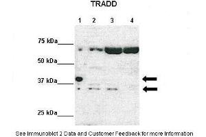 Lanes:   Lane 1: 10ug Tradd-HA-Strep-stable expression 293TREXFlpIn cells-Doxycycline induced Lane 2: 10ug ITradd-HA-Strep-stable expression 293TREXFlpIn cells-non-induced Lane 3: 10ug siRNA scrambled-MDA-MB-231 cells Lane 4: siRNA Tradd-MDA-MB-231 cells  Primary Antibody Dilution:    1:1000  Secondary Antibody:   Anti-rabbit HRP  Secondary Antibody Dilution:    1:2000  Gene Name:   TRADD  Submitted by:   Dr. (TRADD 抗体  (Middle Region))