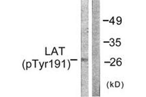 Western blot analysis of extracts from NIH-3T3 cells, using LAT (Phospho-Tyr191) Antibody. (LAT 抗体  (pTyr191))