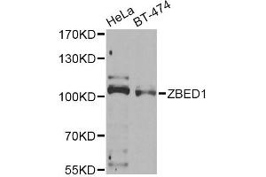 Western blot analysis of extracts of various cell lines, using ZBED1 Antibody (ABIN2560810) at 1:1000 dilution.