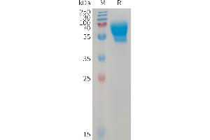 SDS-PAGE (SDS) image for Activin A Receptor Type II-Like 1 (ACVRL1) (AA 22-118) protein (Fc Tag) (ABIN7491397)