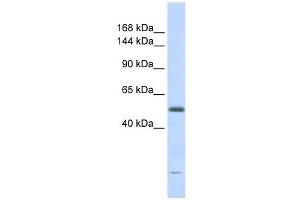 DNA2L antibody used at 1 ug/ml to detect target protein. (DNA2 抗体  (Middle Region))