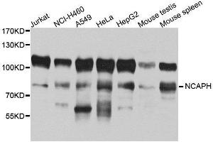 Western Blotting (WB) image for anti-Non-SMC Condensin I Complex, Subunit H (NCAPH) (AA 1-250) antibody (ABIN1680979) (NCAPH 抗体  (AA 1-250))