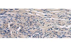 Immunohistochemistry of paraffin-embedded Human brain tissue using CYTIP Polyclonal Antibody at dilution of 1:50(x200)