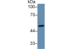Western blot analysis of Human HeLa cell lysate, using Human SFRP4 Antibody (3 µg/ml) and HRP-conjugated Goat Anti-Rabbit antibody ( (SFRP4 抗体  (AA 265-346))