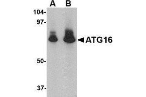 AP20063PU-N ATG16 antibody staining of HeLa Cell Lysate by Western Blotting at (A) 1 and (B) 2 μg/ml.