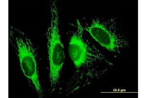 Immunofluorescence of purified MaxPab antibody to TOMM70A on HeLa cell. (TOM70 抗体  (AA 1-608))