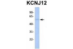 Western Blotting (WB) image for anti-Potassium Inwardly-Rectifying Channel, Subfamily J, Member 12 (KCNJ12) (Middle Region) antibody (ABIN2776235)