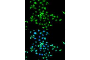 Immunofluorescence analysis of MCF-7 cells using SBDS antibody. (SBDS 抗体  (AA 1-250))
