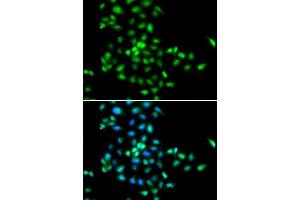 Immunofluorescence analysis of MCF-7 cells using SBDS antibody. (SBDS 抗体  (AA 1-250))