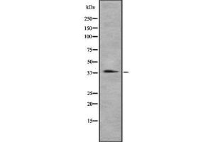Western blot analysis of CCRL2 using A549 whole cell lysates (CCRL2 抗体  (Internal Region))